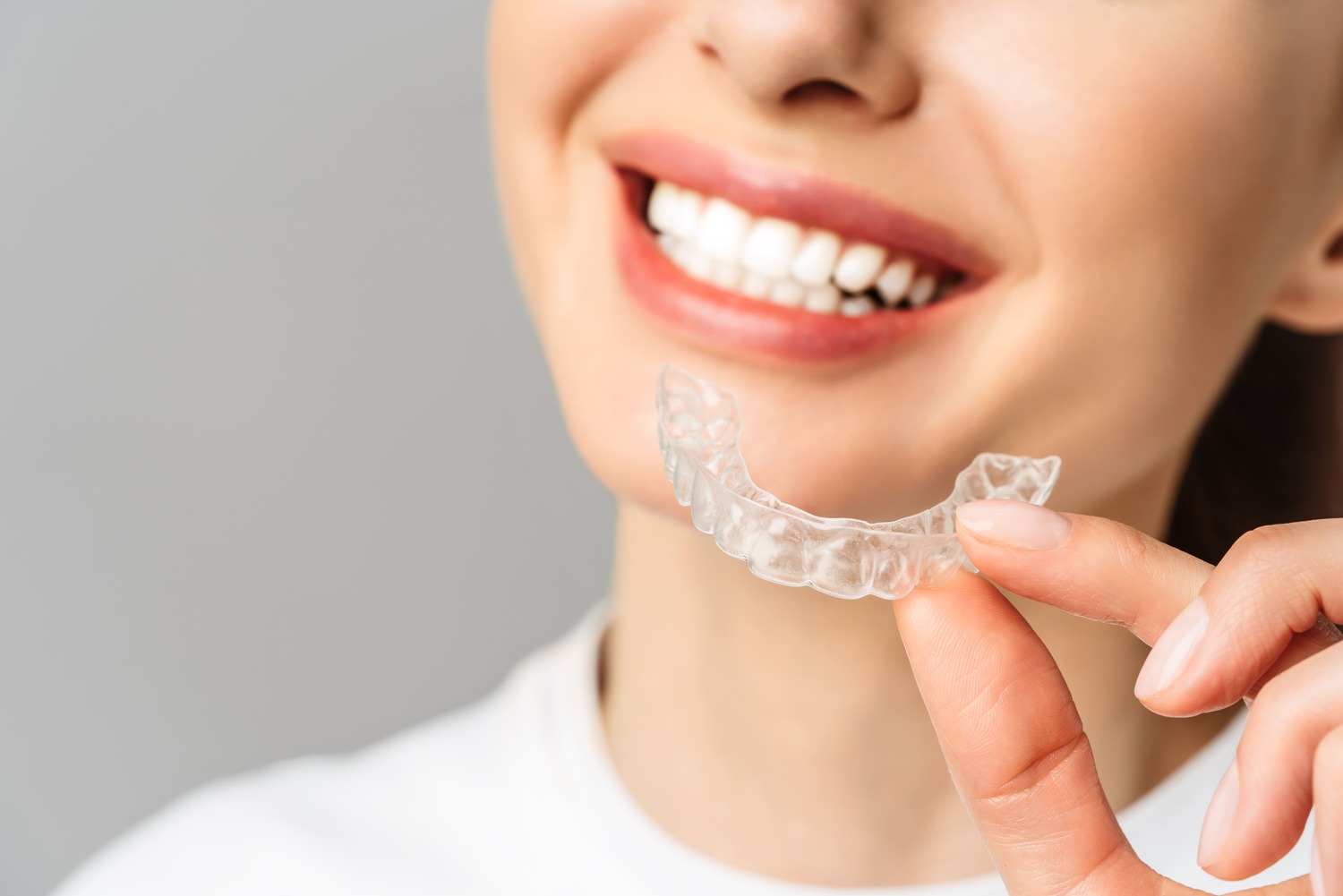 Invisalign beugel